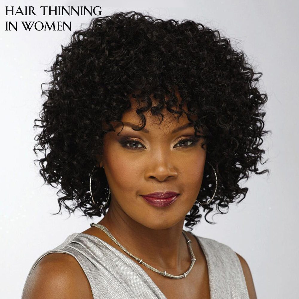 hair thinning in women